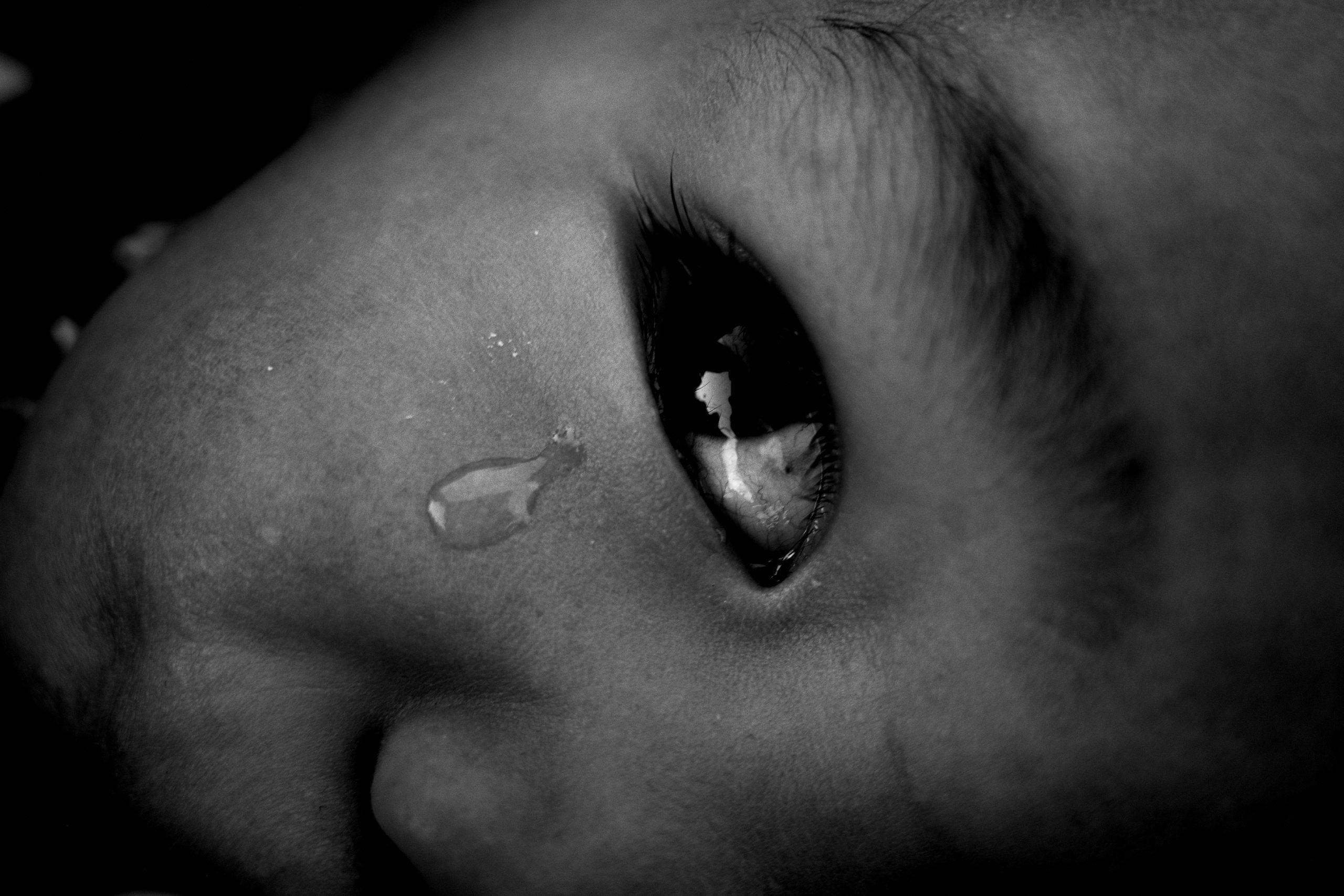 Seneca macro eye tear